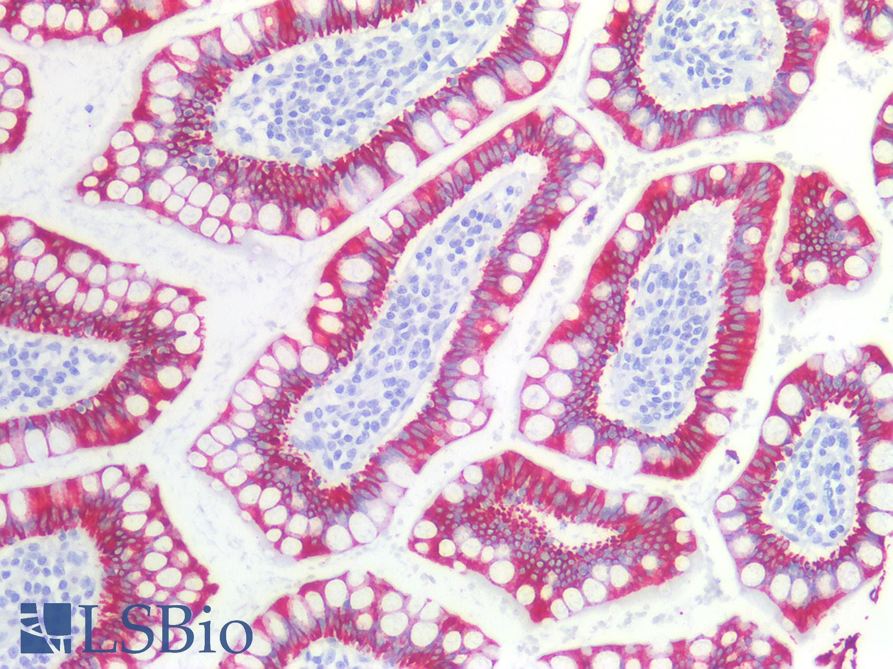 PathPlus™ Monoclonal Mouse anti-Human KRT19 / CK19 / Cytokeratin 19 Antibody (clone BA-17, IHC, WB)