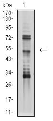 TFAP2B / AP2 Beta Antibody (clone 6E7H11)