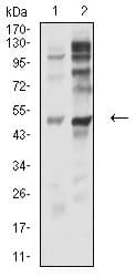 P2RY12 / P2Y12 Antibody (clone 1C2A9)