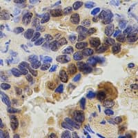 ZAP70 Antibody (C-Terminus)