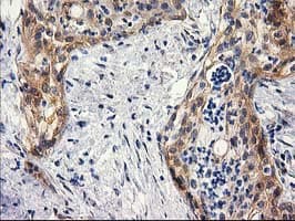 BCAR1 / p130Cas Antibody (clone OTI3A11)