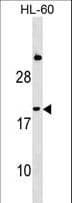 Polyclonal Rabbit anti-Human IFNA1 / Interferon Alpha 1 Antibody (aa164-189, WB)