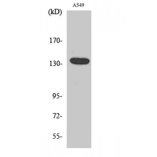ADGRG6 / GPR126 Antibody (1060-1140 aa, C-terminal)