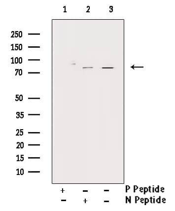 Polyclonal Rabbit anti-Human PRKCZ / PKC-Zeta Antibody (phospho-Thr560, IHC, IF, WB)