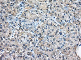 RAB17 Antibody (clone OTI5E2)