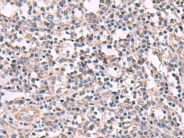 KCNK18 / TRESK Antibody