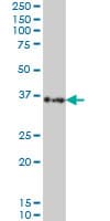 Monoclonal Mouse anti-Human SORD / Sorbitol Dehydrogenase Antibody (clone 4D3, IHC, WB)