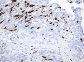 TP / Thymidine Phosphorylase Antibody (aa311-482, clone OTI1E7, Carrier-free)