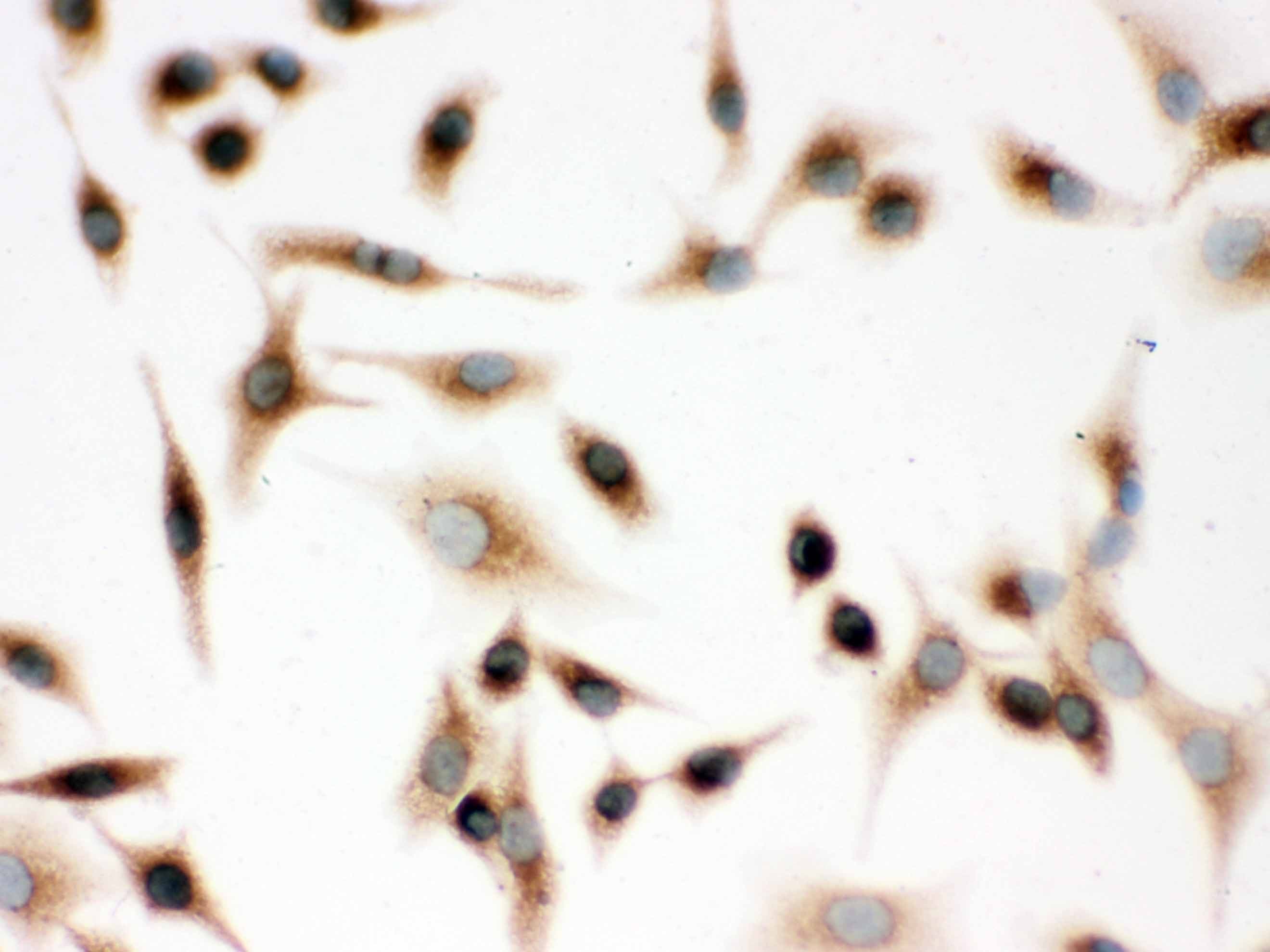 SFTPD / Surfactant Protein D Antibody (aa292-321)