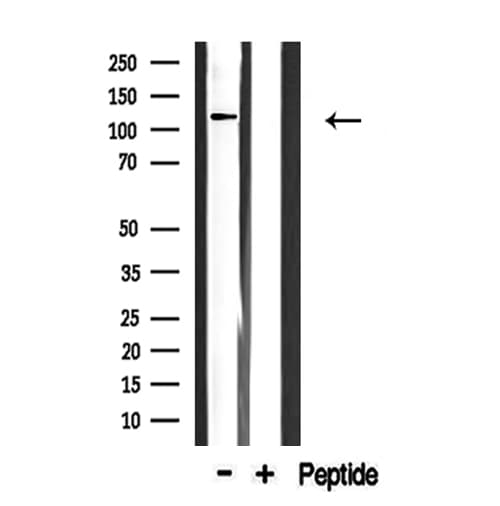 Polyclonal Rabbit anti-Human COL1A2 / Collagen I Alpha 2 Antibody (IHC, IF, WB)