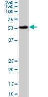 AKT1 Antibody (clone 2E11)