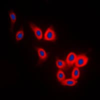 IHC-plus™ Polyclonal Rabbit anti-Human MAPT / Tau Antibody (C-Terminus, IHC, IF, WB)