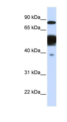 NEXN / Nexilin Antibody (aa252-301)