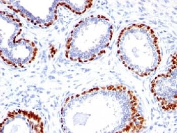 TP63 / p63 Antibody (aa5-17)