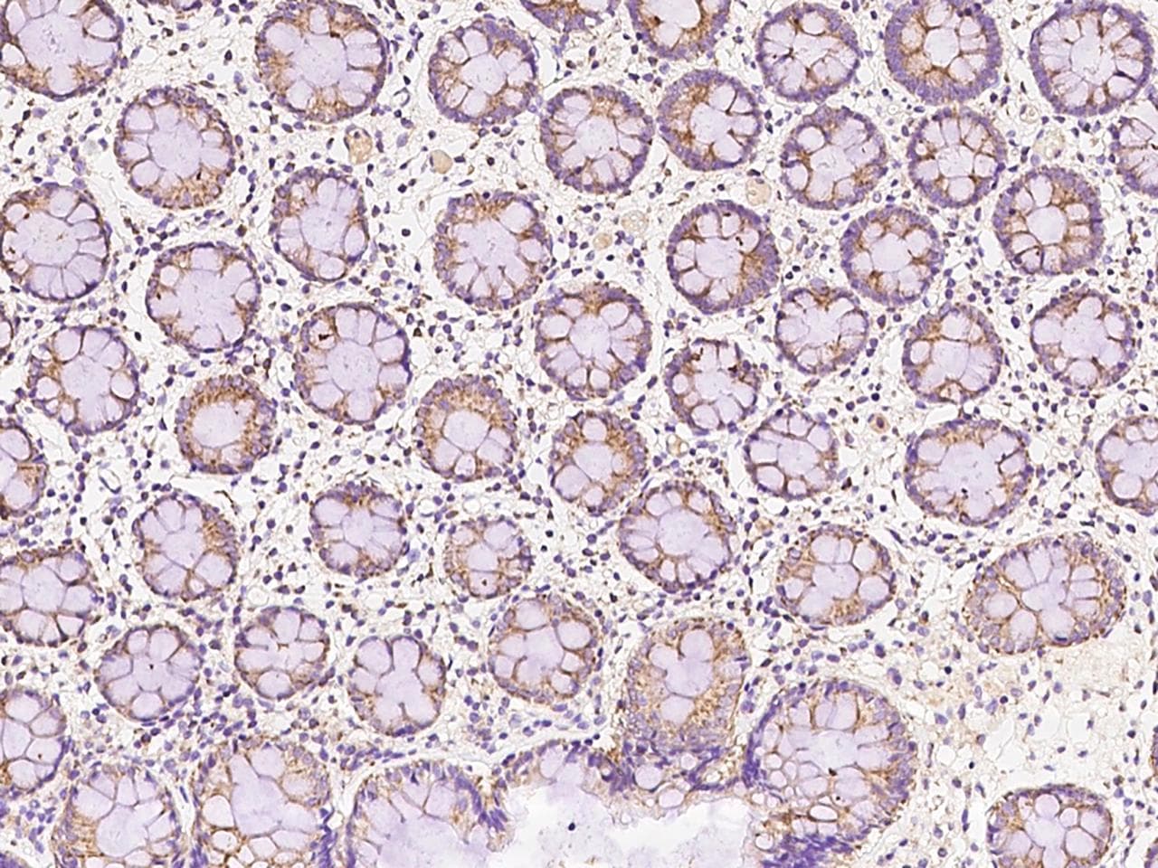 AS3MT Antibody