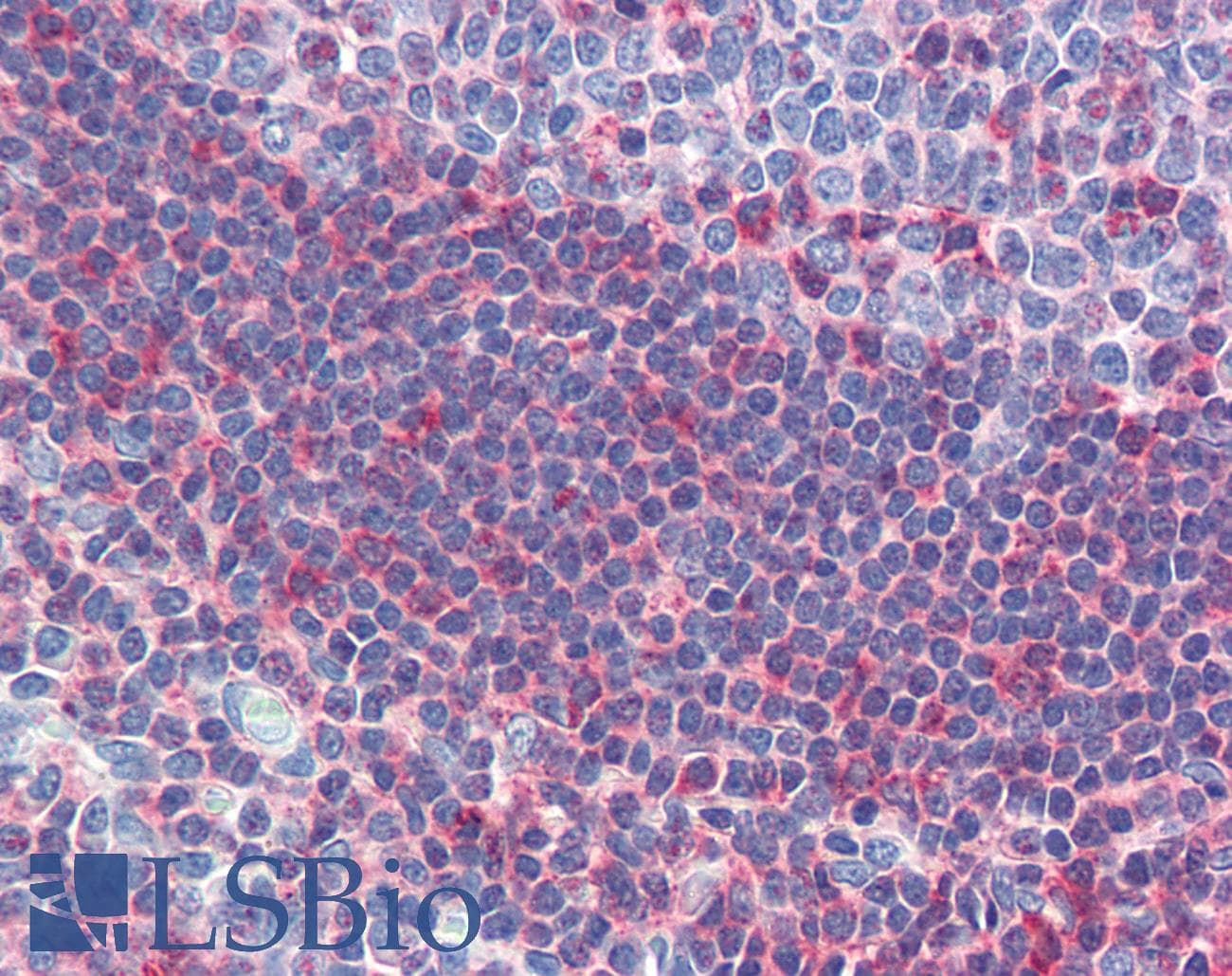 GSC / Goosecoid Antibody (aa35-84)
