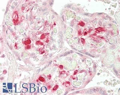 IHC-plus™ MYH9 Antibody (aa 2-241)