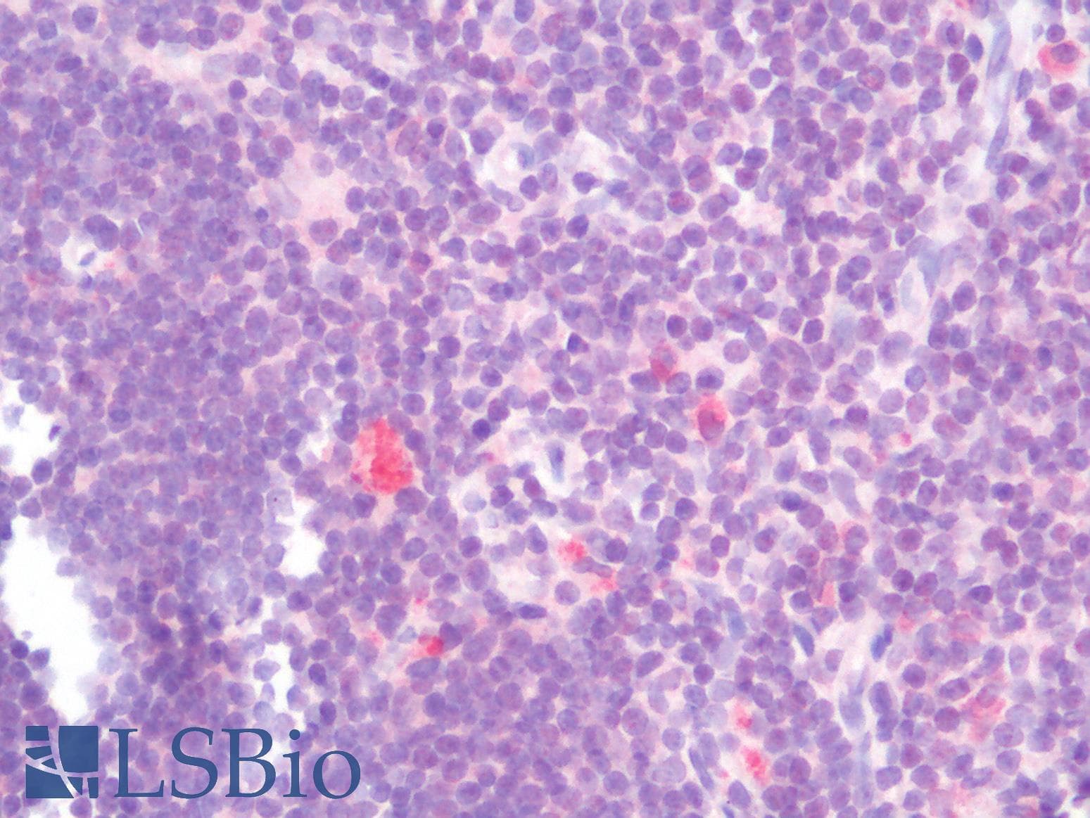 PathPlus™ Polyclonal Rabbit anti-Human CD274 / B7-H1 / PD-L1 Antibody (IHC)