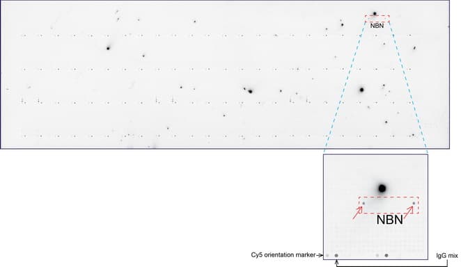 NBN / Nibrin Antibody (aa183-460, clone UMAB100, Carrier-free)