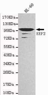IHC-plus™ Monoclonal Mouse anti-Human EEF2 / Elongation Factor 2 Antibody (IHC, WB)