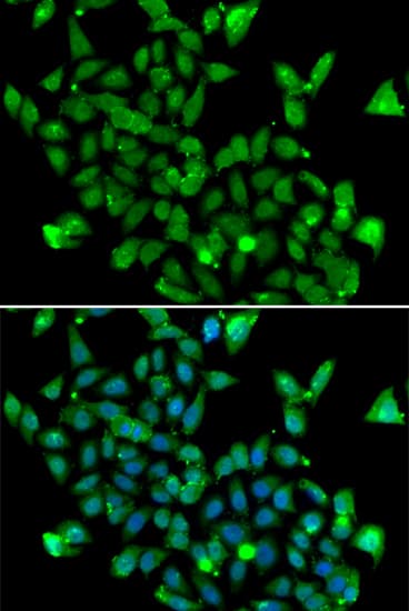 ASPA Antibody