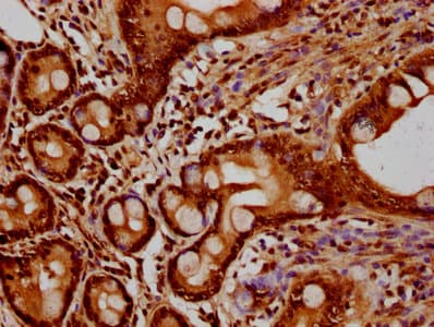 Polyclonal Rabbit anti-Human HIST1H2BN Antibody (IHC, WB)