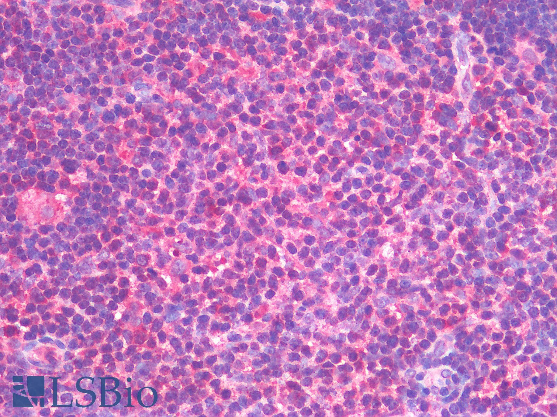 IHC-plus™ TNF Alpha Antibody