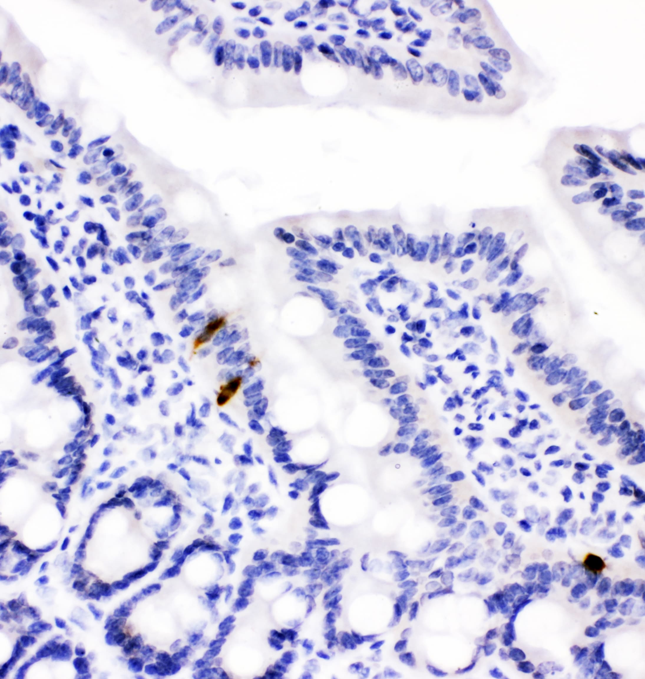 Peptide YY / PYY Antibody