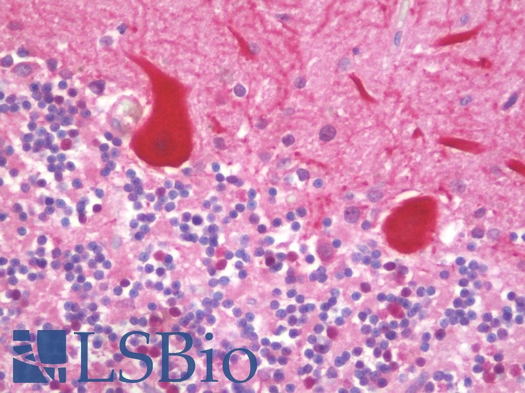 MAGEA3 Antibody (clone OTI1A10)