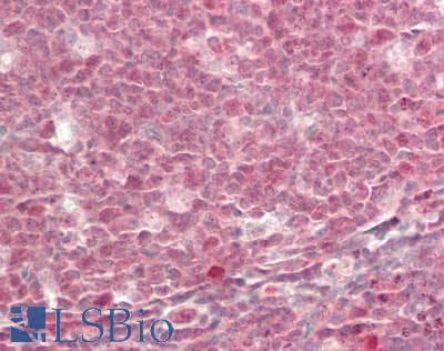 IHC-plus™ MBD3 Antibody