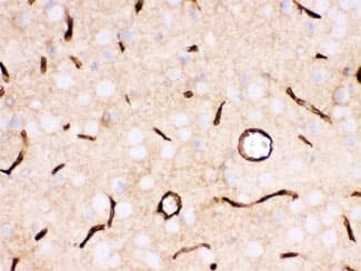 SLC2A1 / GLUT-1 Antibody (aa92-492)