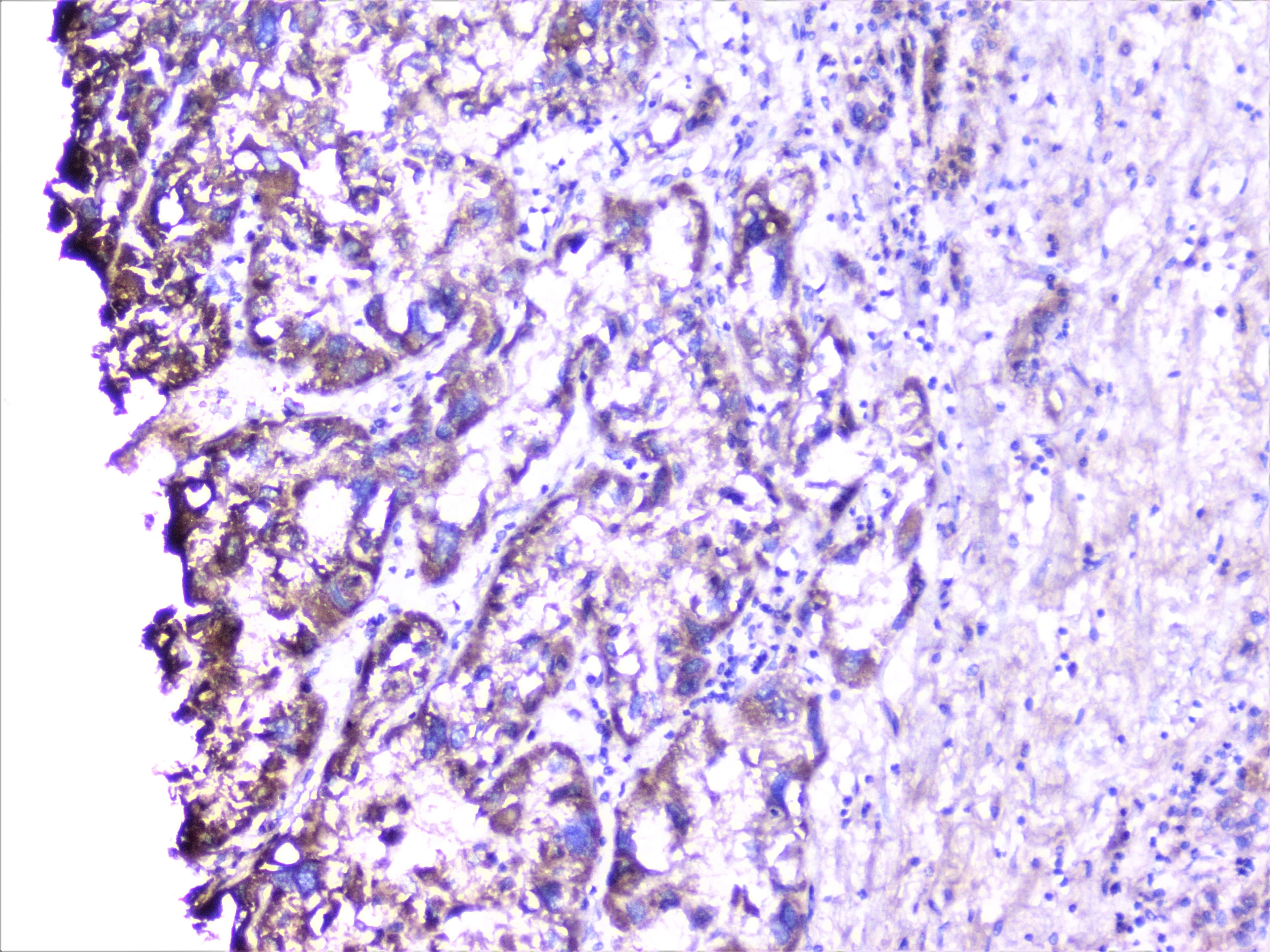 CTTN / Cortactin Antibody