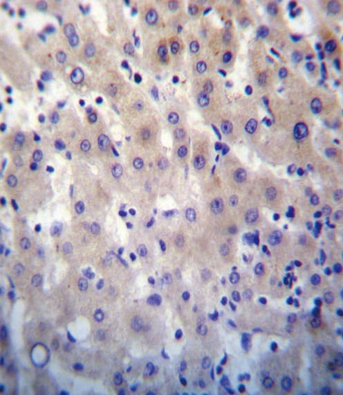 HPRT1 / HPRT Antibody (aa65-94)