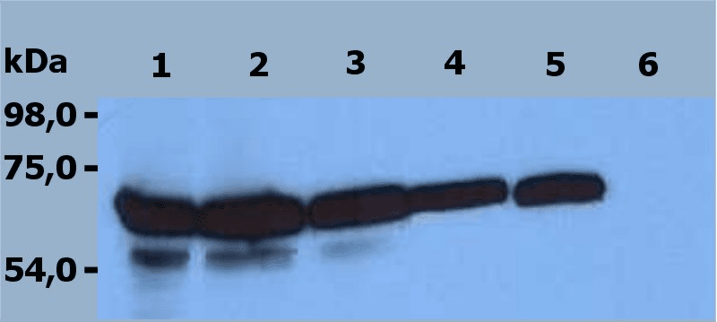 Monoclonal Mouse anti-Human ZAP70 Antibody (clone ZAP-03, C-Terminus, WB)