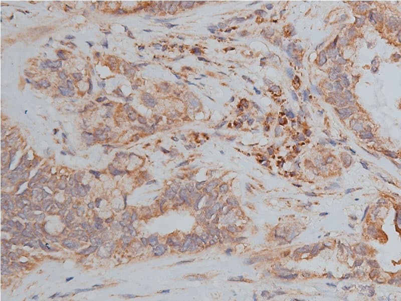 Hamartin / TSC1 Antibody
