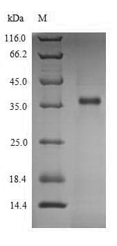 Human LDHC / Lactate Dehydrogenase C Protein (Recombinant 6His, N-terminus)