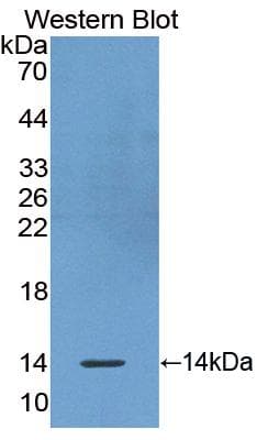 OLFM4 / Olfactomedin 4 Antibody (aa407-510)