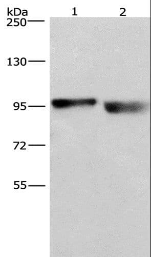 Polyclonal Rabbit anti-Human KIAA1524 / p90 Autoantigen Antibody (WB)