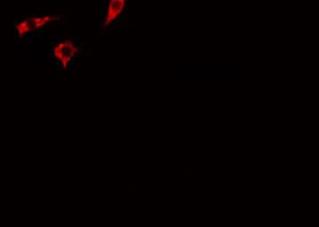 ADAM17 / TACE Antibody (phospho-Thr735)