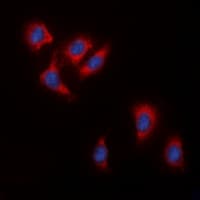 IHC-plus™ Polyclonal Rabbit anti-Human RAF1 / RAF Antibody (C-Terminus, IHC, IF, WB)