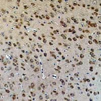 Monoclonal Mouse anti-Human AQP4 / Aquaporin 4 Antibody (IHC, IF, WB)