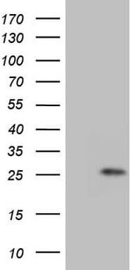 Monoclonal Mouse anti-Human GLYAT Antibody (clone OTI2E12, Carrier-free, WB)