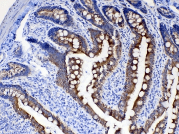 KRT8 / CK8 / Cytokeratin 8 Antibody