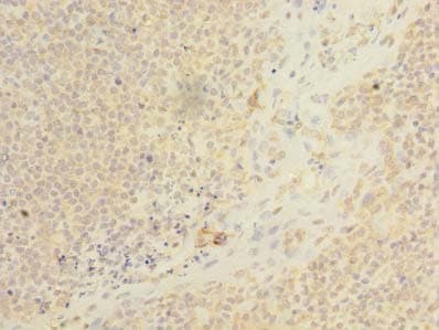 ARMC9 Antibody