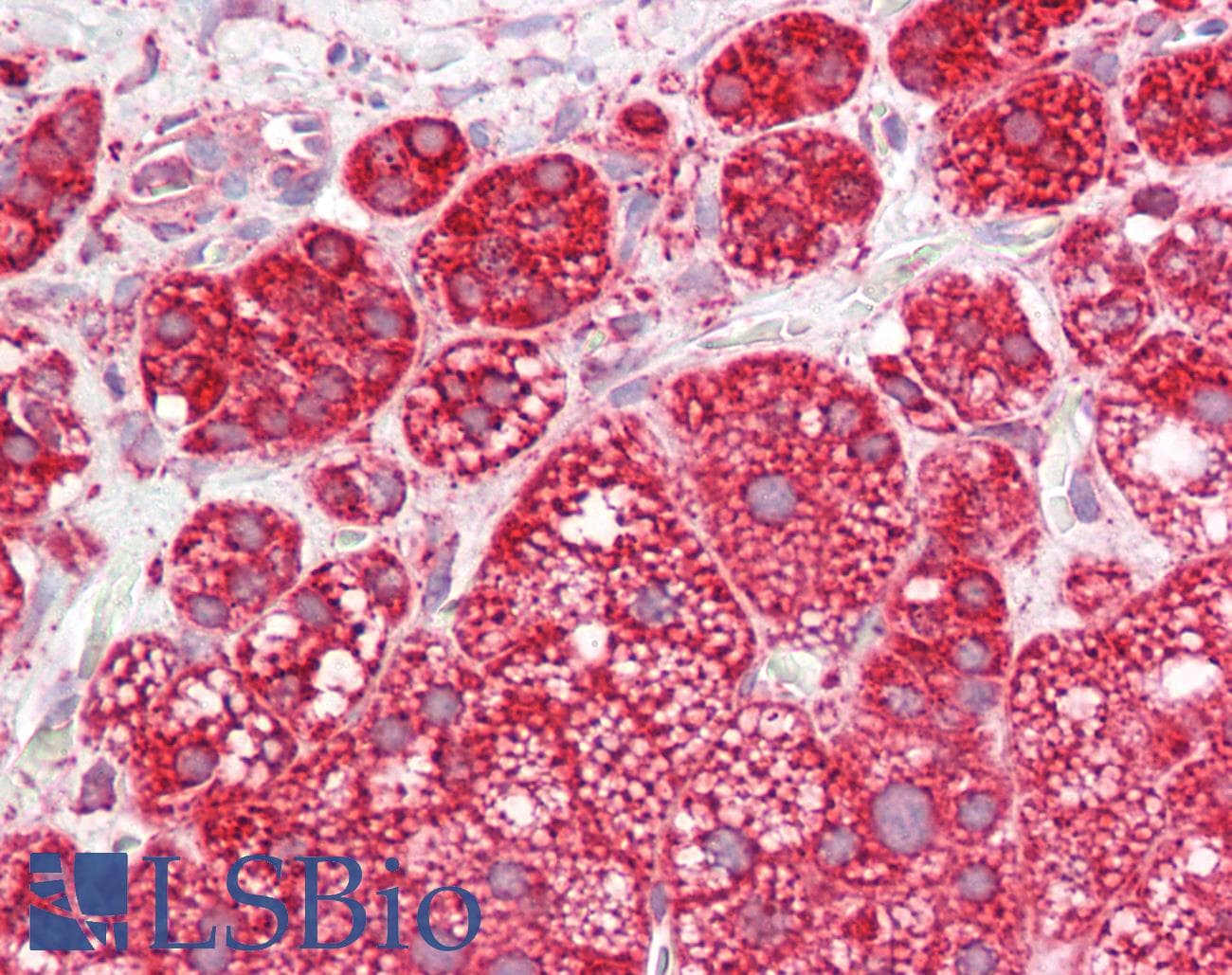 IHC-plus™ Polyclonal Rabbit anti-Human PPIF / Cyclophilin F Antibody (aa86-135, IHC, WB)