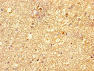NIM1K / NIM1 Antibody