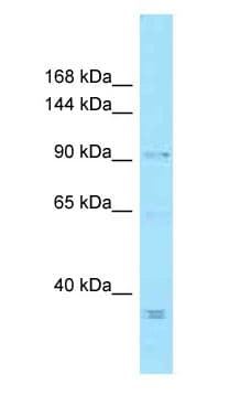 Polyclonal Rabbit anti-Human MCPH1 Antibody (aa619-668, WB)