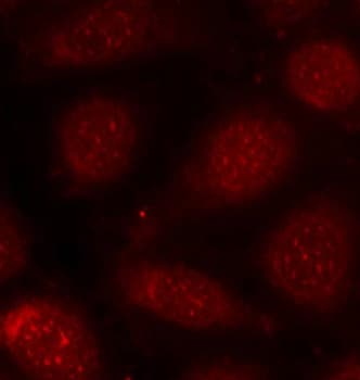 PRKCB / PKC-Beta Antibody (phospho-Thr641)