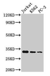 HIST1H1D Antibody