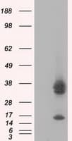 PIM2 / Pim-2 Antibody (clone OTI8H10)